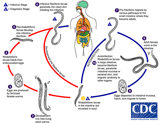 CDC - DPDx - Strongyloidiasis