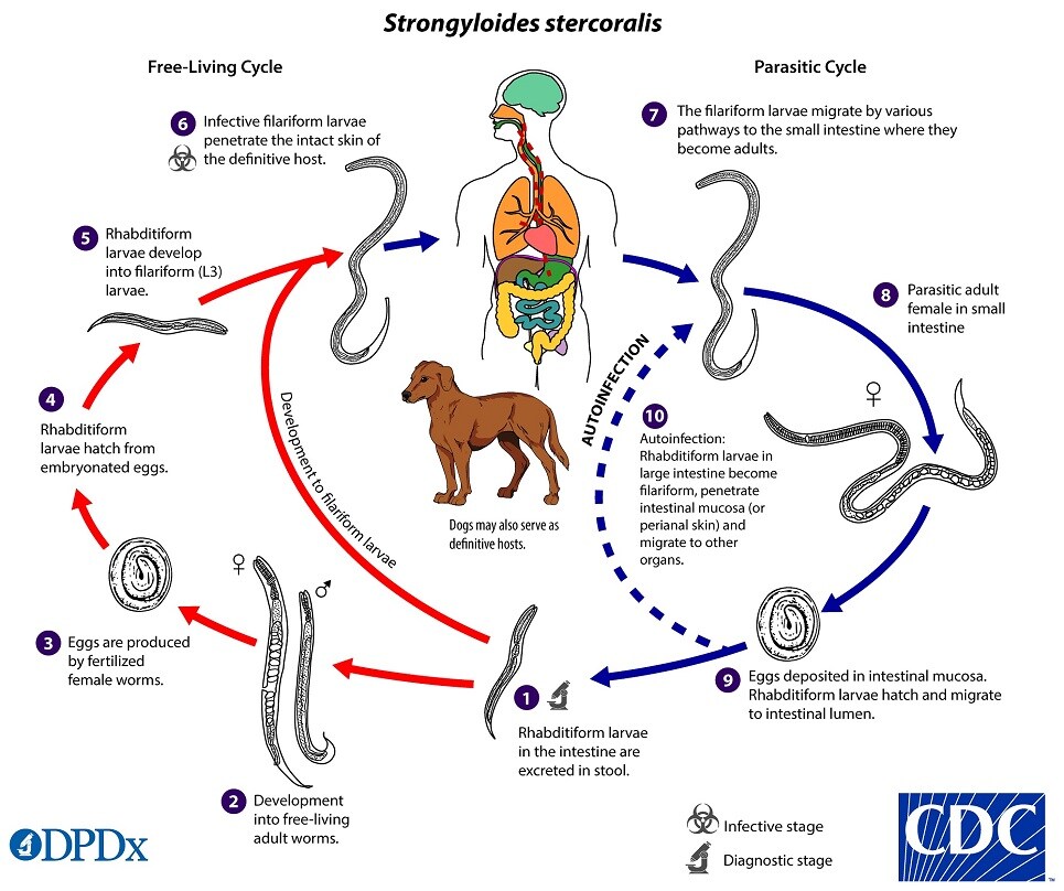 CDC DPDx Strongyloidiasis