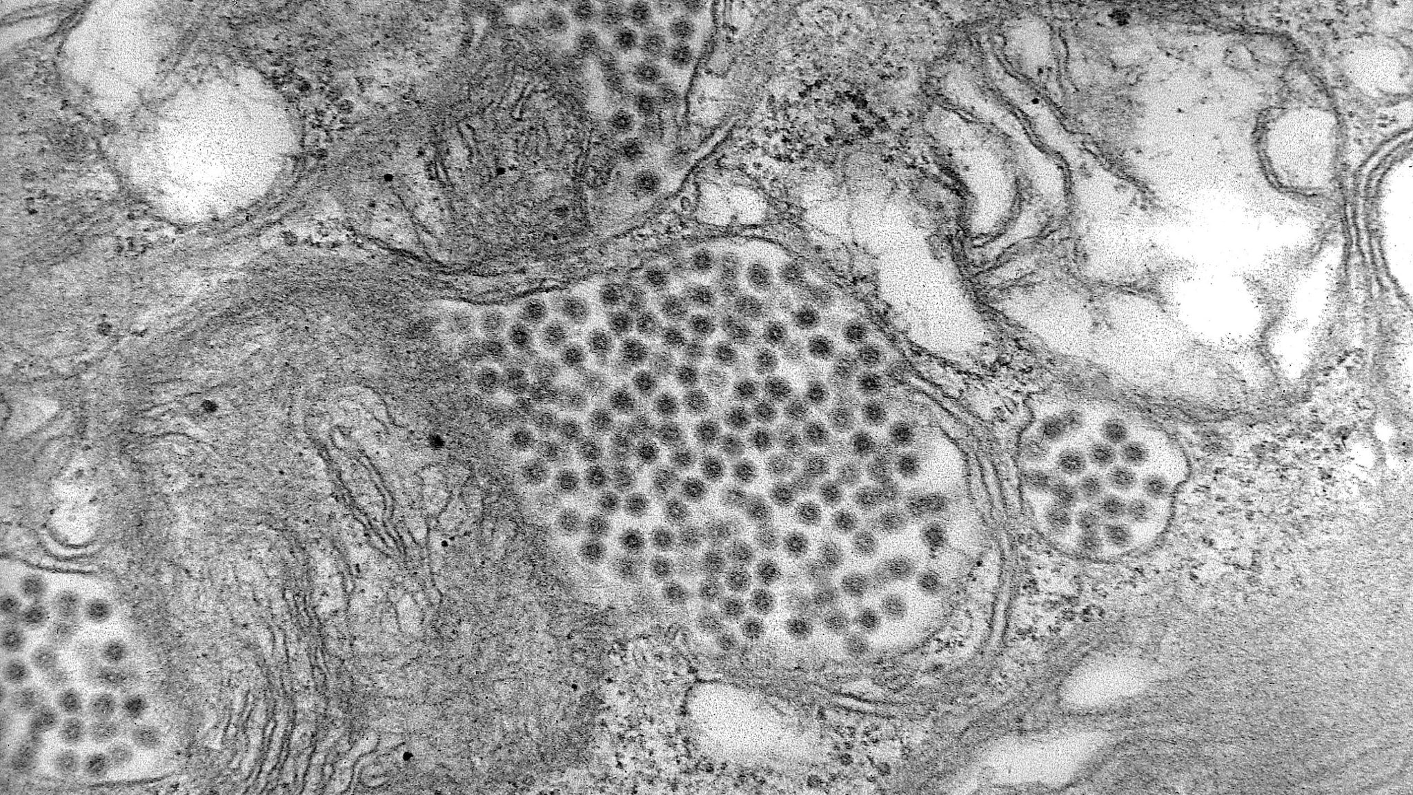 Electron microscopic image of eastern equine encephalitis virus particles in mosquito salivary gland tissue.