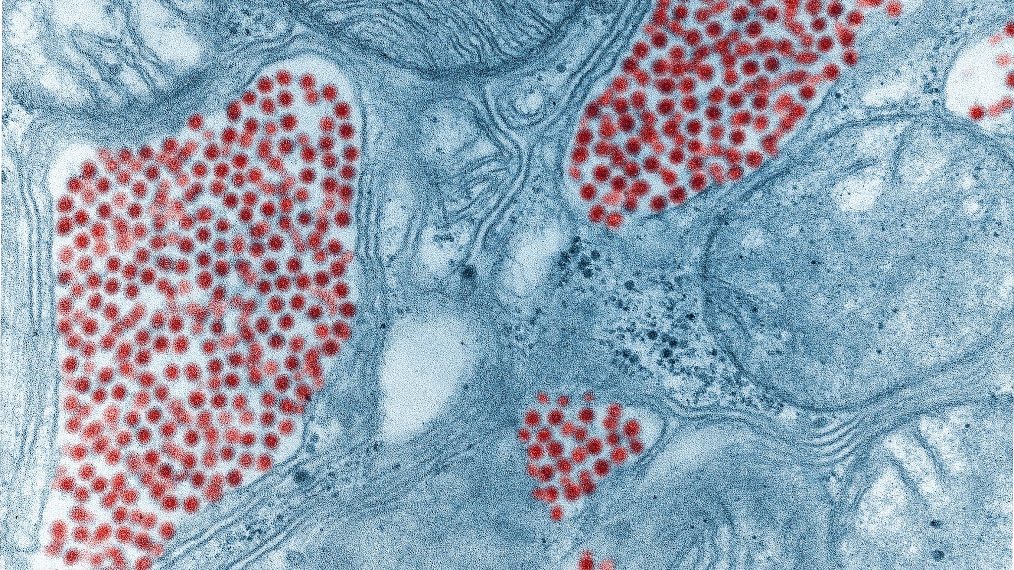 Electron microscope image of eastern equine encephalitis virus