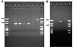 Thumbnail of A: Polymerase chain reaction (PCR) amplification products with primers targeted against the class 1–specific conserved sequences. Lane 1: no template control; lane 2: positive control (In2); lane 3: Escherichia coli isolate 16; lane 4: E . coli isolate 19; lane 5: E. coli isolate 21; lane 6: blank; lane 7: E. coli isolate I-6. B: PCR amplification products with primers targeted against the class 2–specific conserved sequences. Lane 1: no template control; lane 2: positive control (I