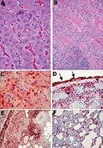 Thumbnail of Representative photomicrographs of histologic changes and immunohistochemical staining of tissues from ground squirrels infected with monkeypox virus. A) Liver from a ground squirrel (intranasal infection) showing mild degenerative changes, including early steatosis, and purple-colored viral cytoplasmic inclusion bodies in the hepatocytes (40x objective). B) Spleen from a ground squirrel infected intraperitoneally, showing extensive necrosis (20x objective). C) Liver showing positiv