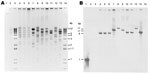 Thumbnail of XmnI restriction analysis of New Delhi metallo-β-lactamase (NDM)–encoding plasmids, United States, April 2009–March 2011, from transformants (A) and subsequent Southern blot analysis with digoxigenin-labeled blaNDM probe hybridized to a blot of same gel (B). Lane 1, NDM PCR product, positive control; lane 2, NDM-negative plasmid (ATCC-1705); lanes 3 and 14, 1-kb plus marker; lane 4, TF 0S-506; lane 5, TF 1100770; lane 6, TF 1100975; lane 7, TF1100192; lane 8, TF 1000527; lane 9, TF 