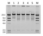 Thumbnail of EcoRI restriction profile of fosA3-carrying plasmids from a woman in Pennsylvania, USA, who  was colonized with fosfomycin-resistant Escherichia coli. Lanes M, lambda DNA/HindIII marker; lane 1, February 2011 (YD472); lane 2, March 2008; lane 3, June 2007 (ECRB1); lane 4, April 2008; lane 5, January 2008. Values on the left are in kilobases.