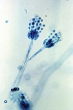 Thumbnail of Two conidiophores of Penicillium frequentans fungi, also known as P. glabrum. The conidiophore is the stalked structure whose distal end produces asexual spores (conidia) by budding. Original magnification x1,200.  Photo: CDC/Lucille Georg/1971.