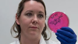 A laboratorian holding up a plate stained with Elizabethkingia.