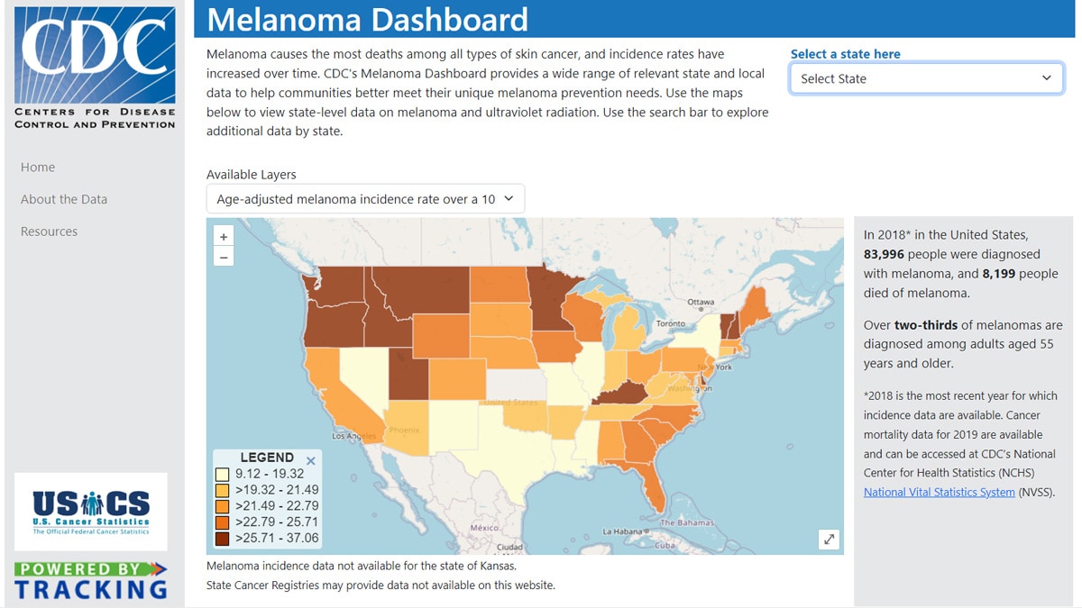 Screenshot of Tracking's Melanoma Dashboard tool