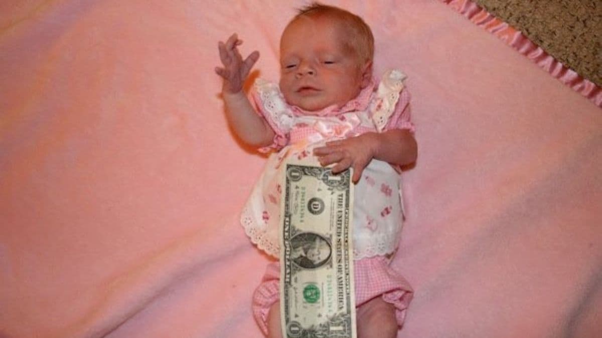 Image of infant Brenna, showing she was not much bigger than a dollar bill