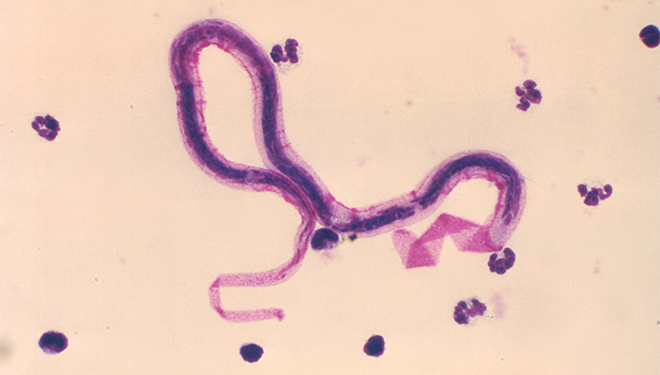 Ultrastructural details of Brugia malayi, one of the parasites responsible for LF.