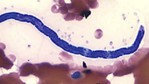 Microfilaria of L. loa.