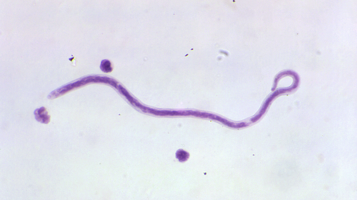 Mansonella perstans microfilaria