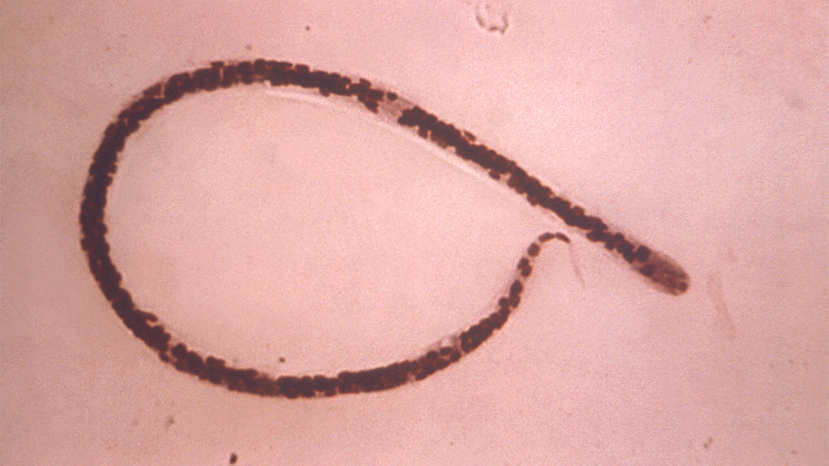 Onchocerca volvulus larva