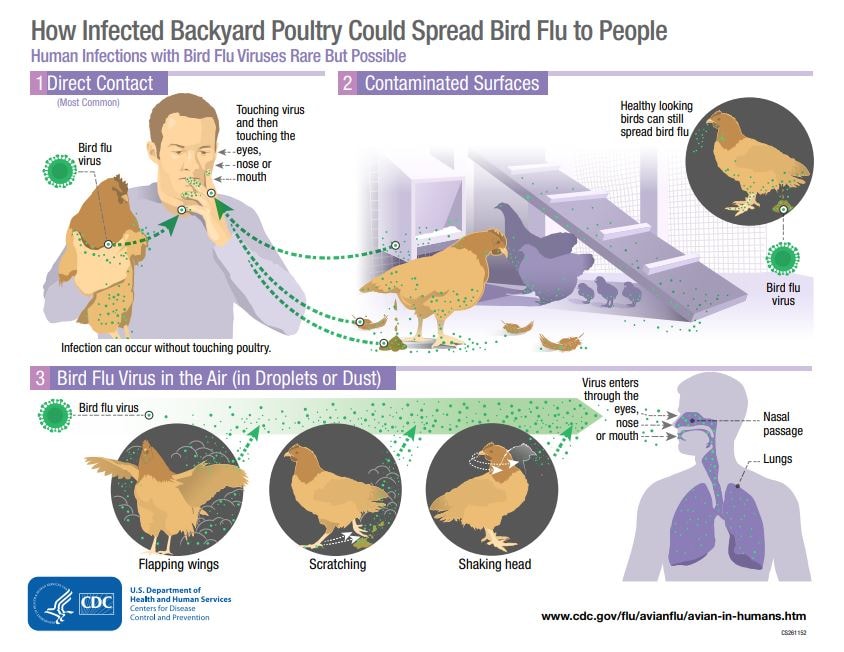 Current U.S. Bird Flu Situation in Humans Avian Influenza (Flu)