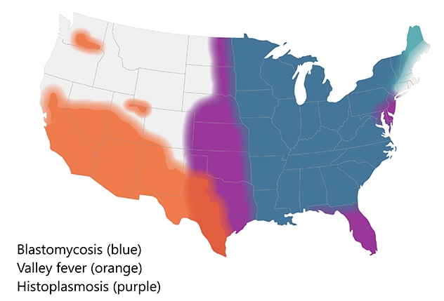 map of continental US showing range of blastomycosis (east of the Mississippi), valley fever (southwest), and histoplasmosis (midwest with pockets in FL and New England)