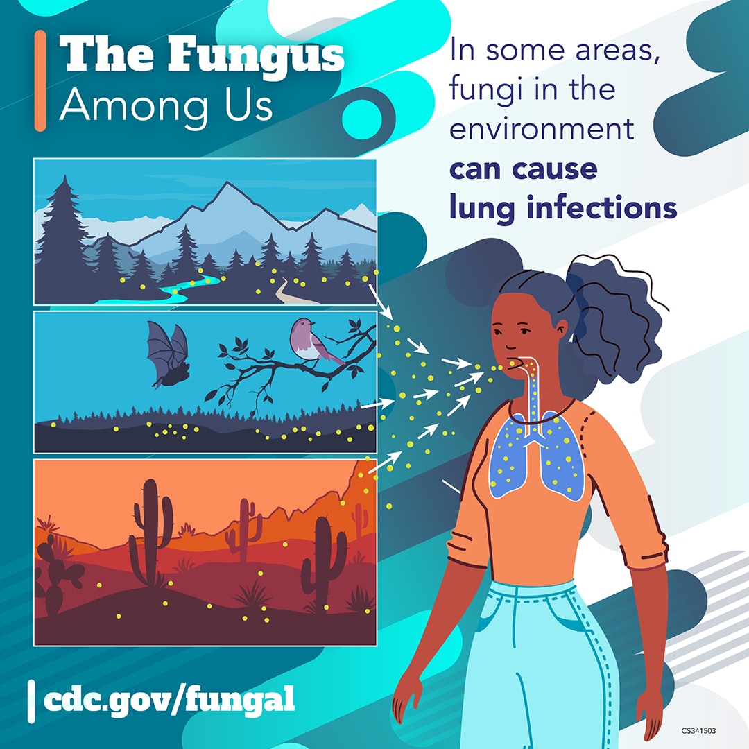 The Fungus Among Us: In some areas, fungi in the environment can cause lung infections cdc.gov/fungal