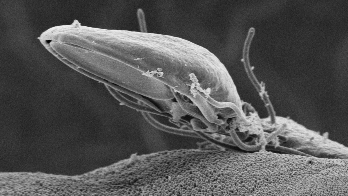 Scanning electron microscopic image of a Giardia parasite over an intestinal cell. The parasite has a disc on its underside and moving hair-like structures.