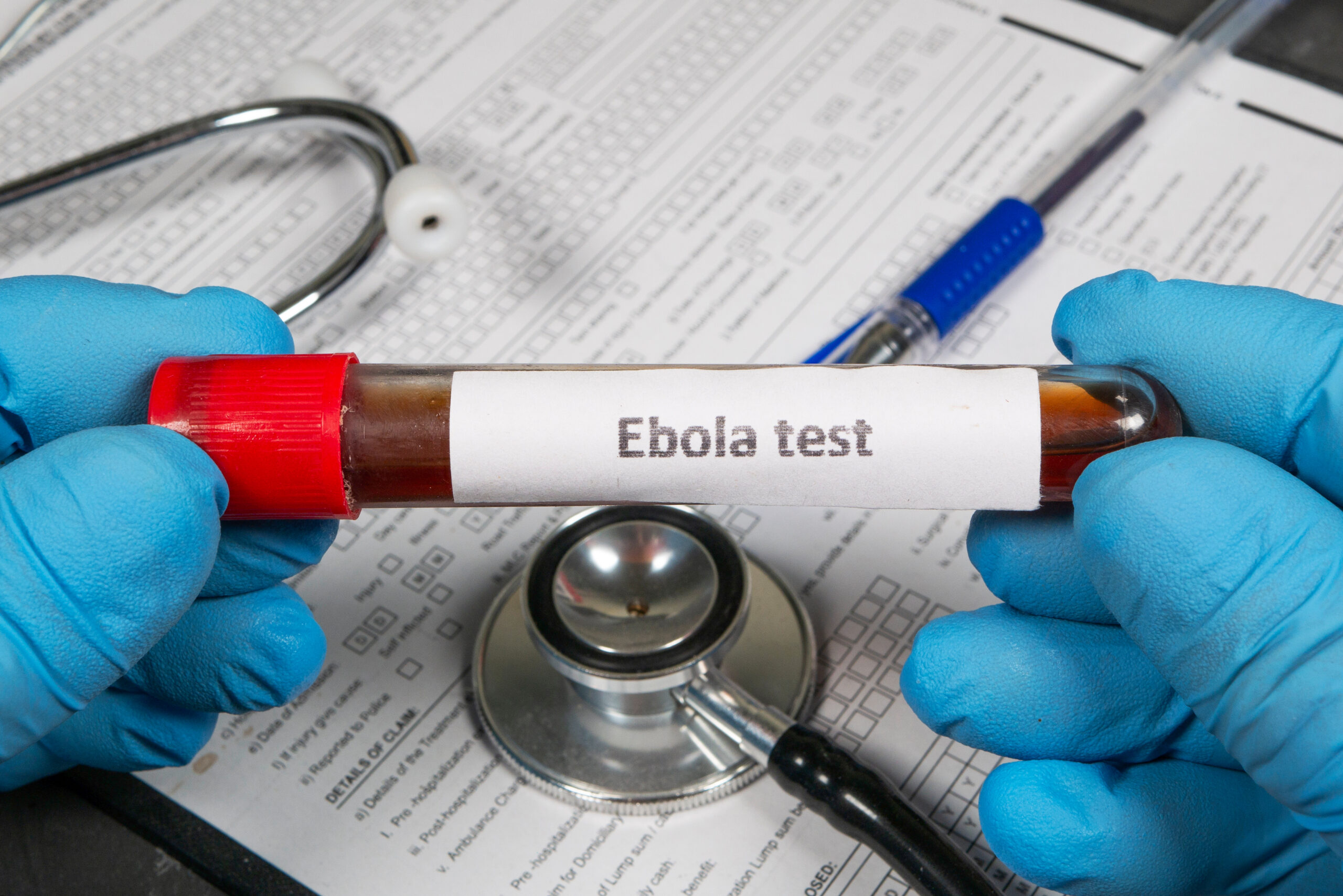 A laboratory sample test tube with the text "Ebola test" is held by two hands with blue gloves. The background shows a medical record paper and a stethoscope.