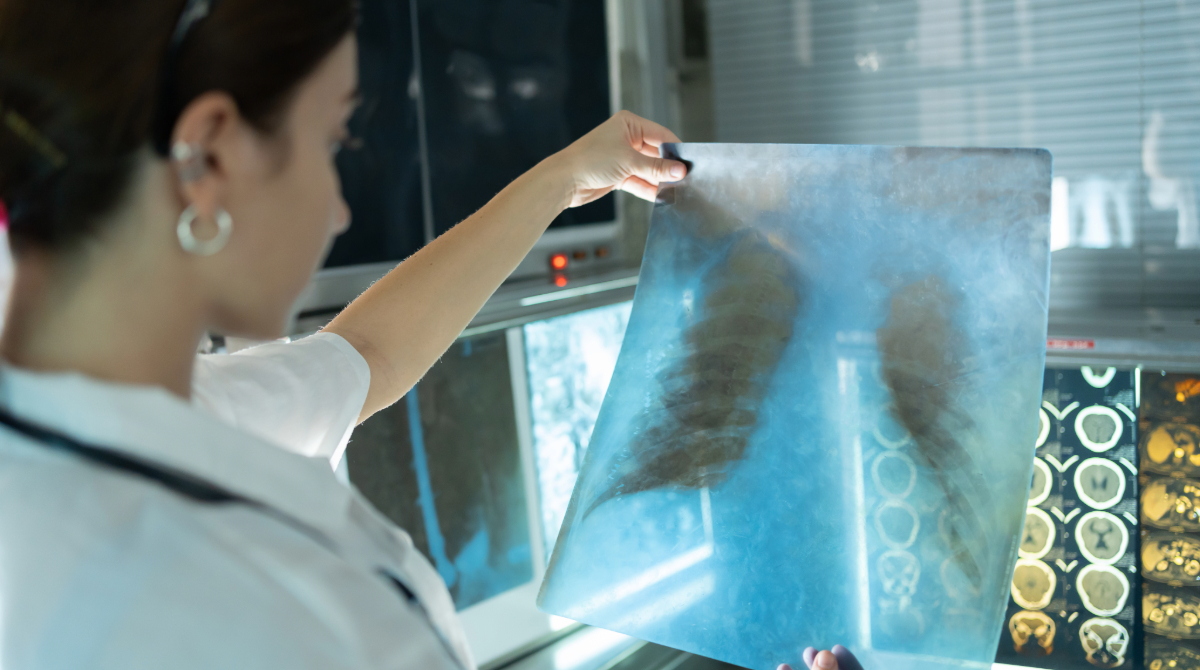 A healthcare professional in a white coat examines a chest X-ray film in front of a medical imaging lightbox.
