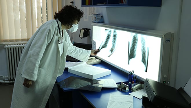 A woman in a white coat looks at chest X-rays.