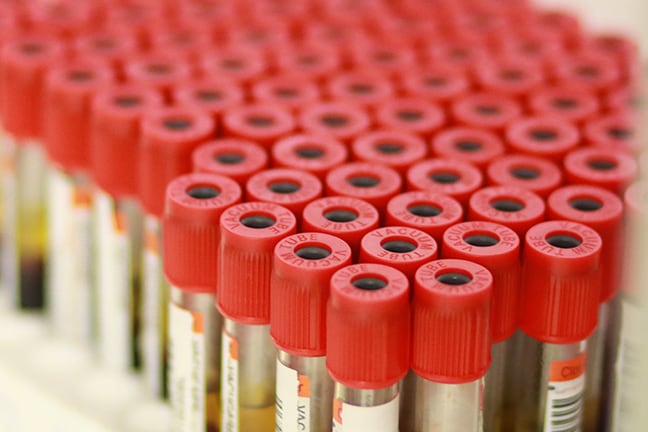 A collection of vials of blood being tested for safety.