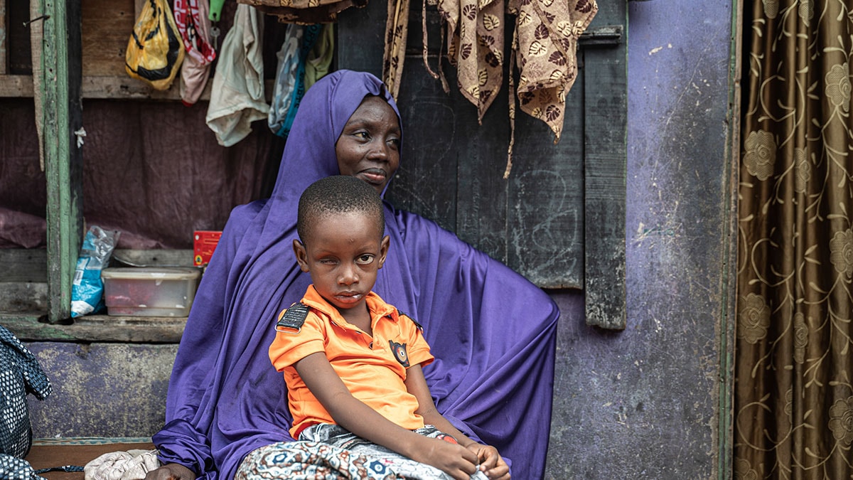 A boy with a drooping eye sits in his mother's lap in Nigeria.