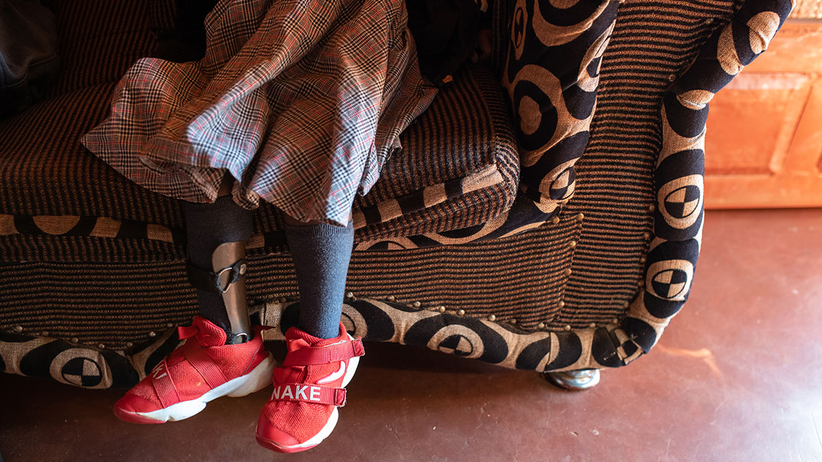 The legs of a little girl sitting on a couch. She is wearing a plaid dress and red tennis shoes, and there is a brace on her right leg, which is tilted to the side.