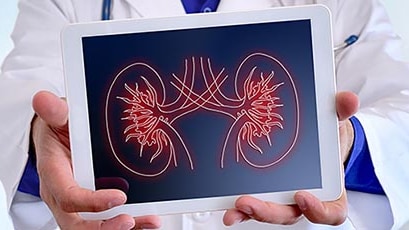 Médico sosteniendo una tableta que muestra una ilustración de los riñones.