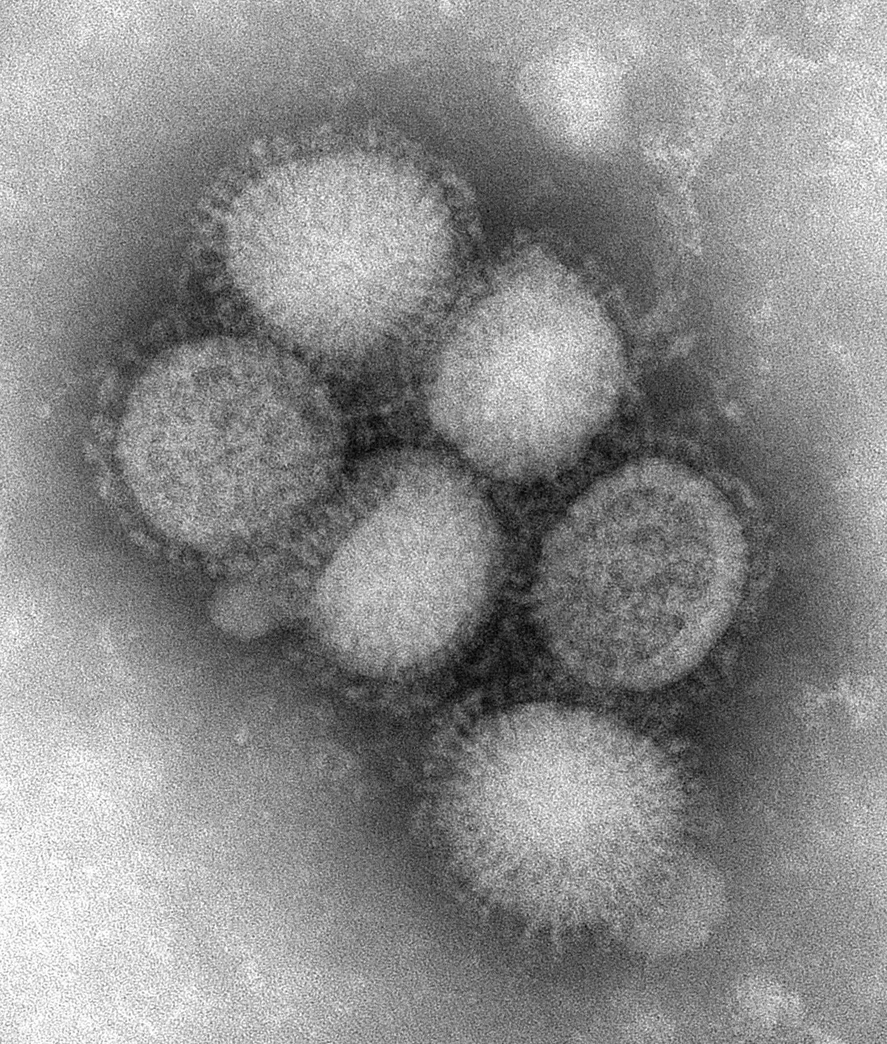 CDC H1N1 Flu Images of the H1N1 Influenza Virus