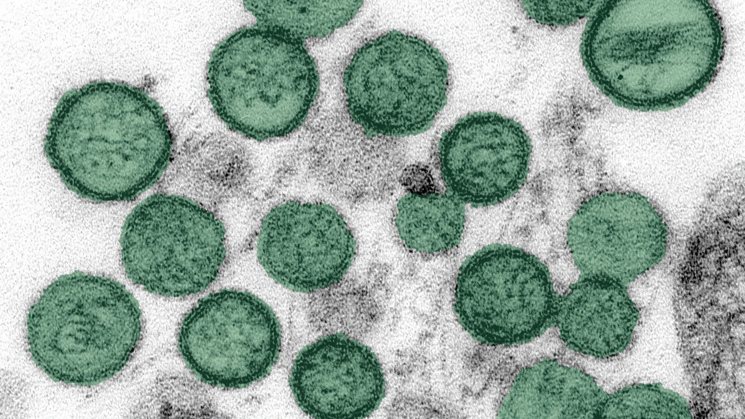 Microscopic image of hantavirus. Virus particles have been colored green.