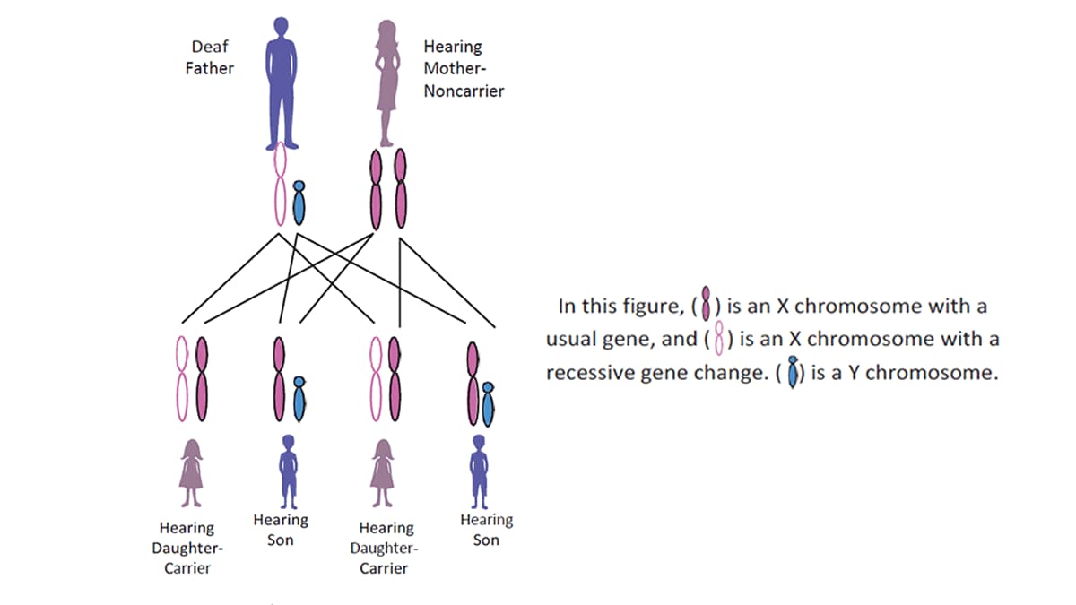 Figure of the chromosomes passed down from a deaf father and hearing mother who is a non-carrier of the recessive gene of deafness, to their children.