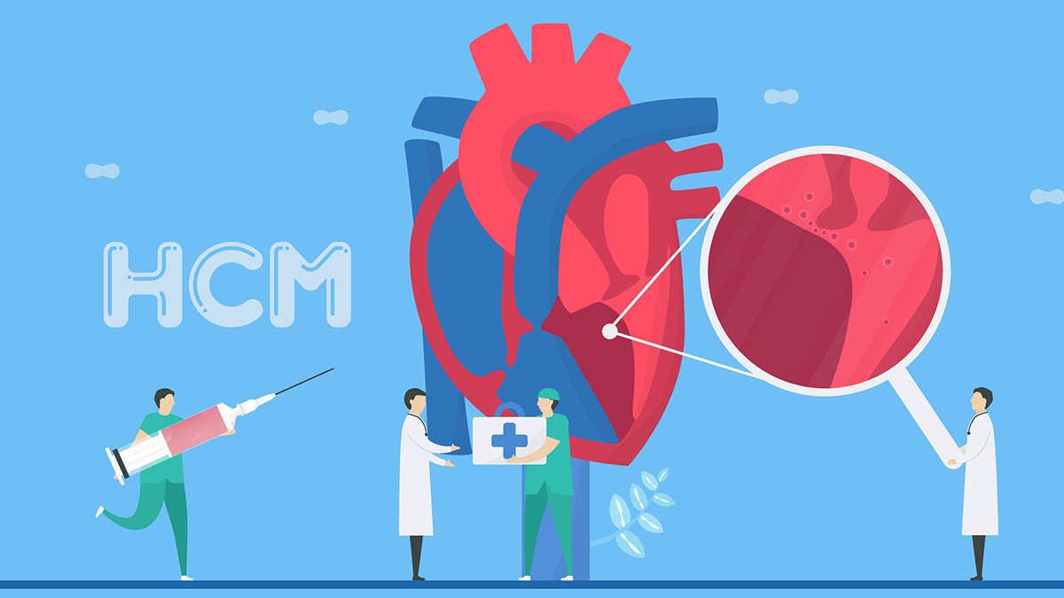 Illustration of a heart with small cartoon medical professionals surrounding it