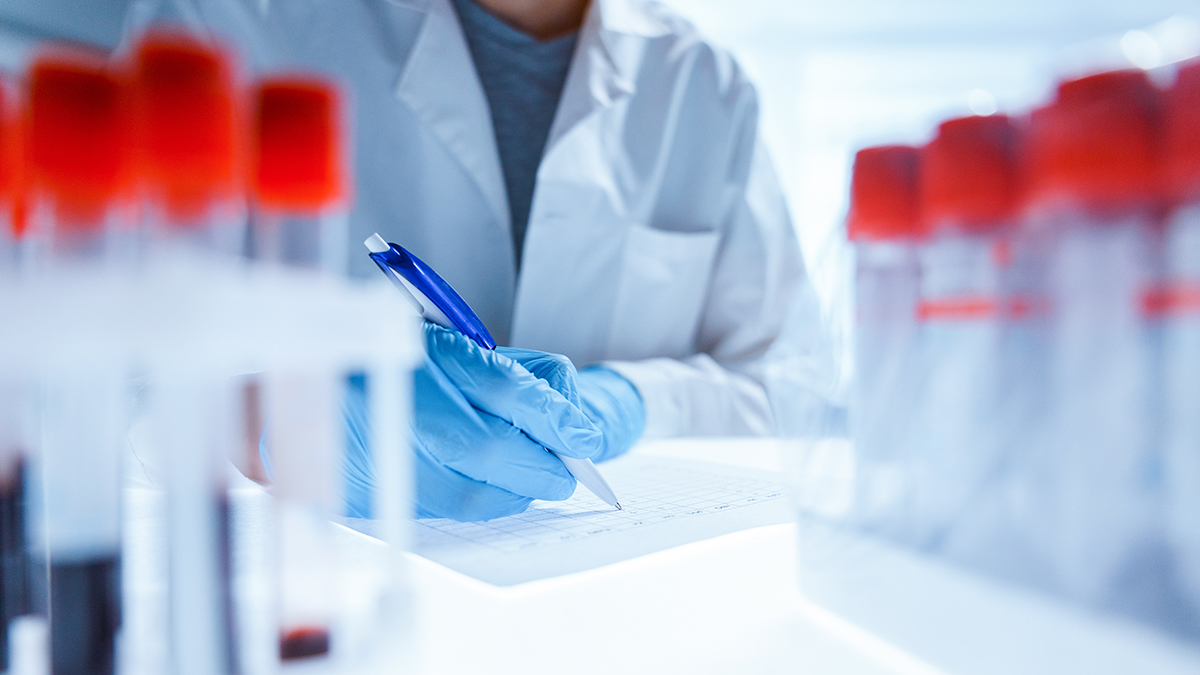 Healthcare professional in their lab conducting hepatitis laboratory testing