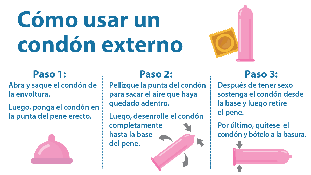 Cómo usar un condón externo; paso 1: Abra y saque el condón de la envoltura. Luego, ponga el condón en la punta del pene erecto; paso 2: Pellizque la punta del condón para sacar el aire que haya quedado adentro; luego, desenrolle el condón completamente hasta la base del pene; paso 3: Después de tener sexo sostenga el condón desde la base y luego retire el pene; por último, quítese el condón y bótelo a la basura.