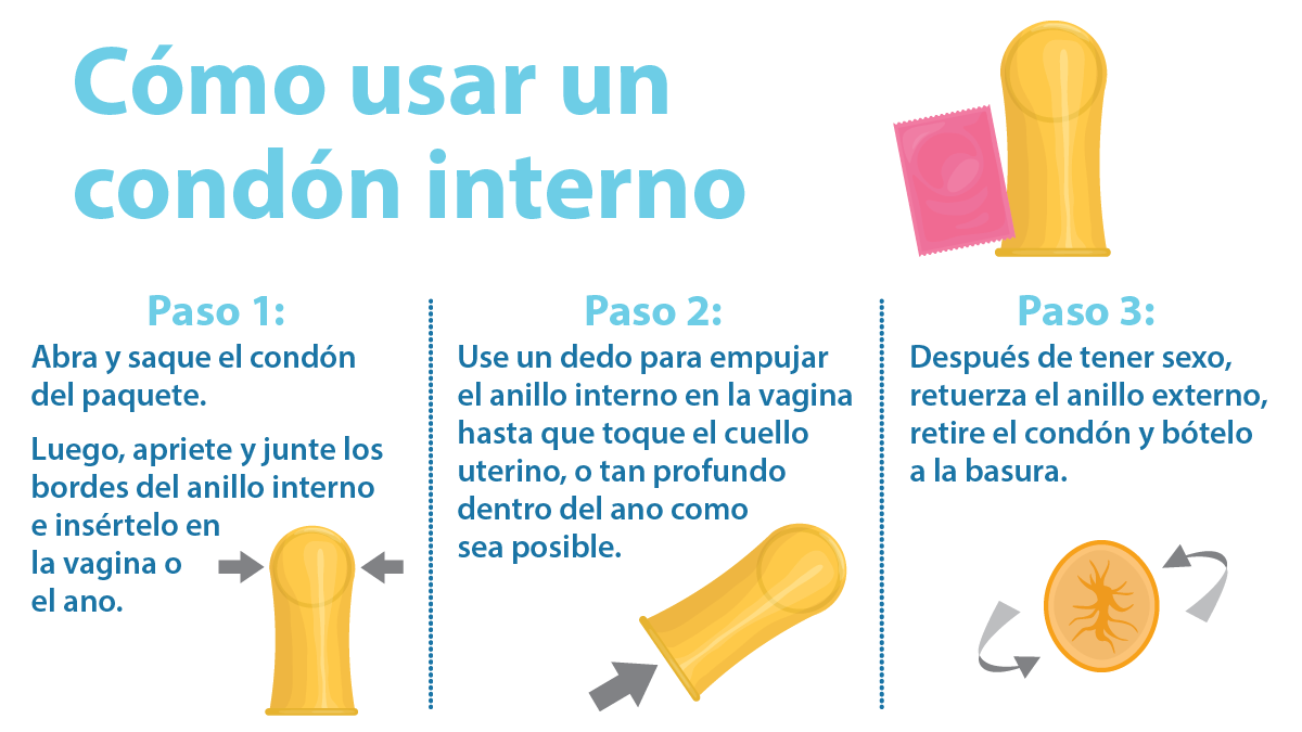 Cómo usar un condón interno; paso 1: Abra y saque el condón del paquete; luego, apriete y junte los bordes del anillo interno e insértelo en la vagina o el ano; paso 2: Use un dedo para empujar el anillo interno en la vagina hasta que toque el cuello uterino, o tan profundo dentro del ano como sea posible; paso 3: Después de tener sexo, retuerza el anillo externo, retire el condón y bótelo a la basura.