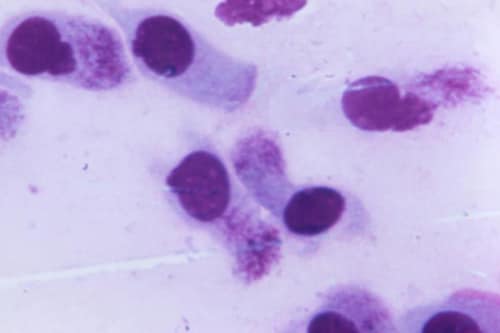 This is photomicrograph of a conjunctival smear that revealed the presence of what are known as, intracytoplasmic inclusions
