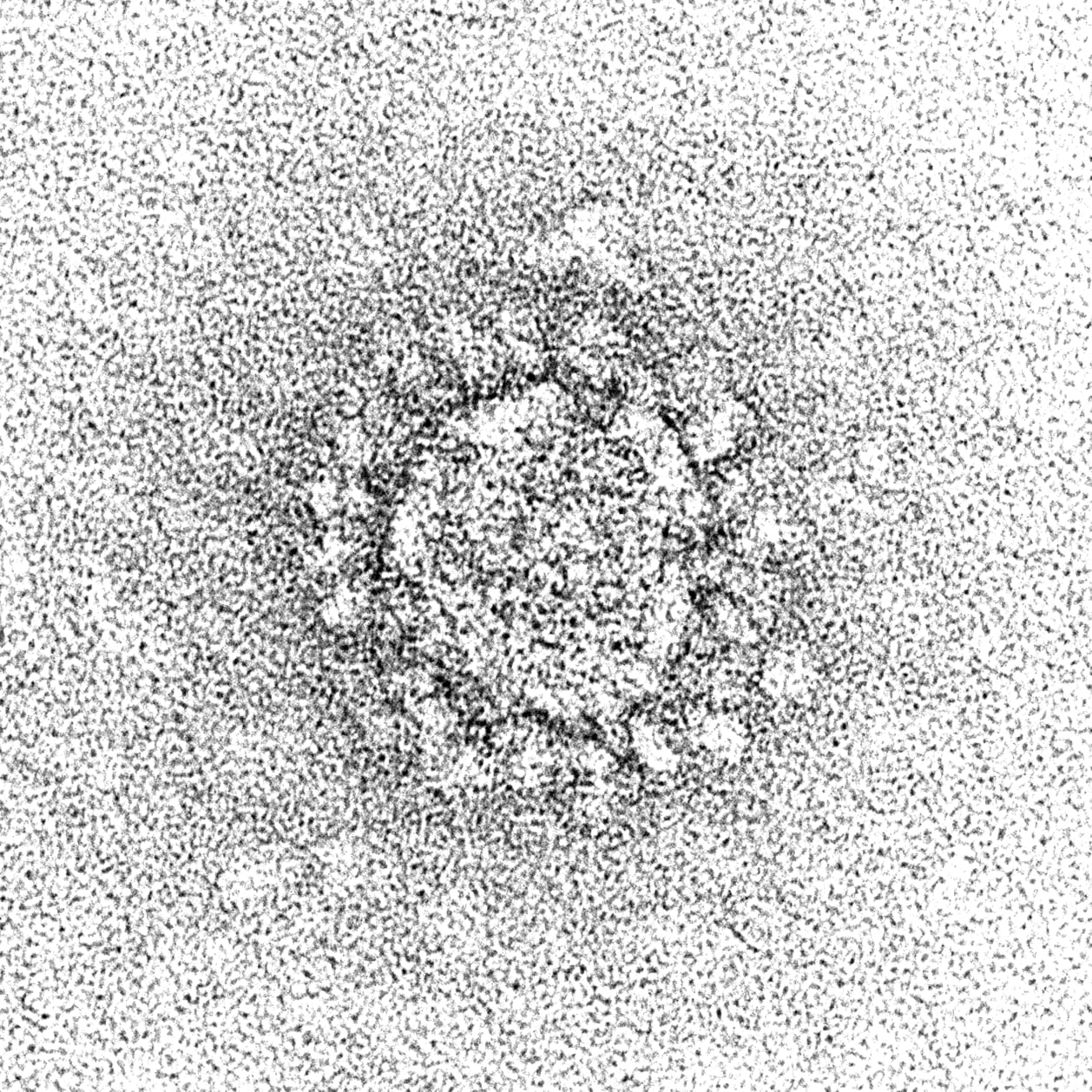 Negative stain electron microscopy identifying cause of 2003 SARS outbreak as a coronavirus
