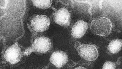 Negative-stained transmission electron microscopic (TEM) image revealed the presence of La Crosse (LAC) encephalitis virus ribonucleoprotein particles.