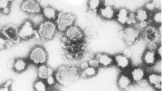 Electron microscopic image of La Crosse virus