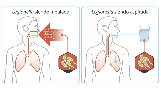 Illustraciones que muestran una persona inhalando pequeña gotitas de agua que contienen Legionella y agua entrándole en los pulmones mientras la toma.