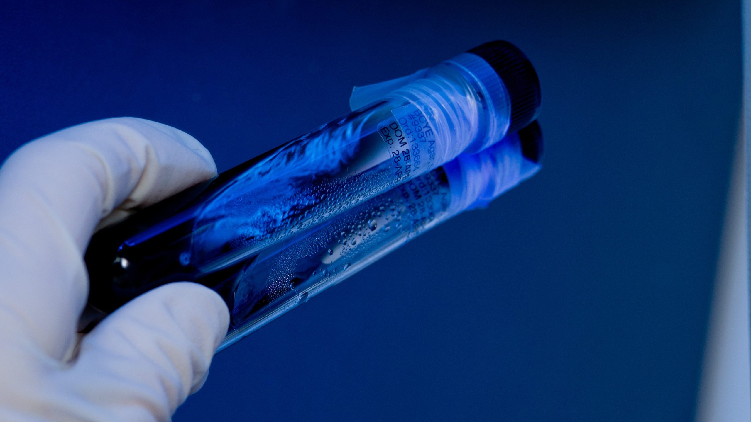 Legionella bacteria growing on slants.