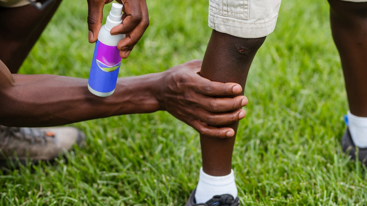 A dad applies insect repellent to his child's leg to prevent tick bites.