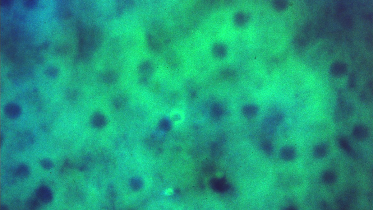A photomicrograph of the malaria parasite.