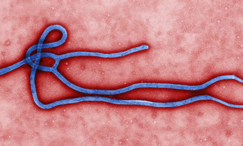Ebola virus