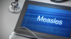 Measles