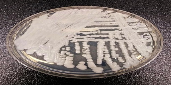 Notes from the Field: Ongoing Transmission of Candida auris in Health ...