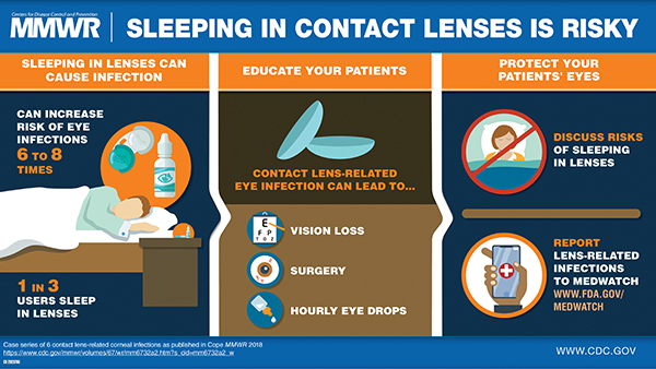 mm6732a2_Corneal_Infections_Contact_Lenses_600x338 The figure above is a visual abstract that discusses the risk for sleeping in contacts.
