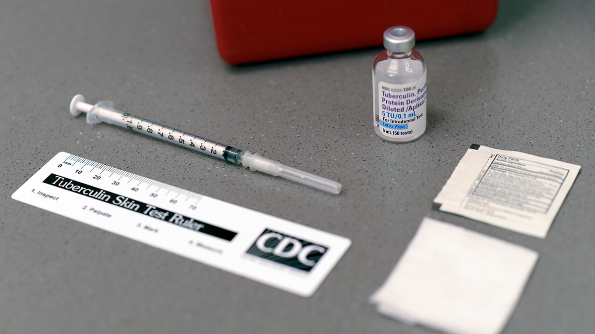 Nationwide Shortage of Tuberculin Skin Test Antigens CDC