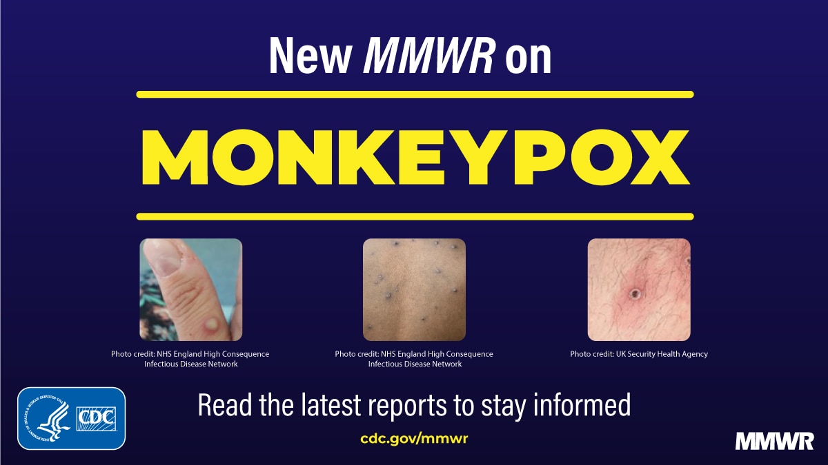 What EMS should know about monkeypox patient care and provider safety