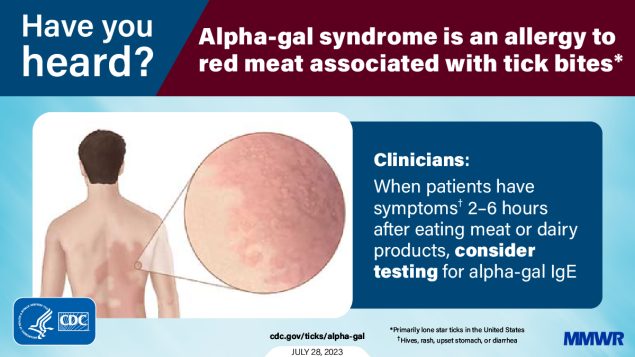 Health Care Provider Knowledge Regarding Alpha-gal Syndrome — United States, March–May 2022 The figure is a graphic with an illustration of a rash on a person’s back with text about alpha-gal syndrome.