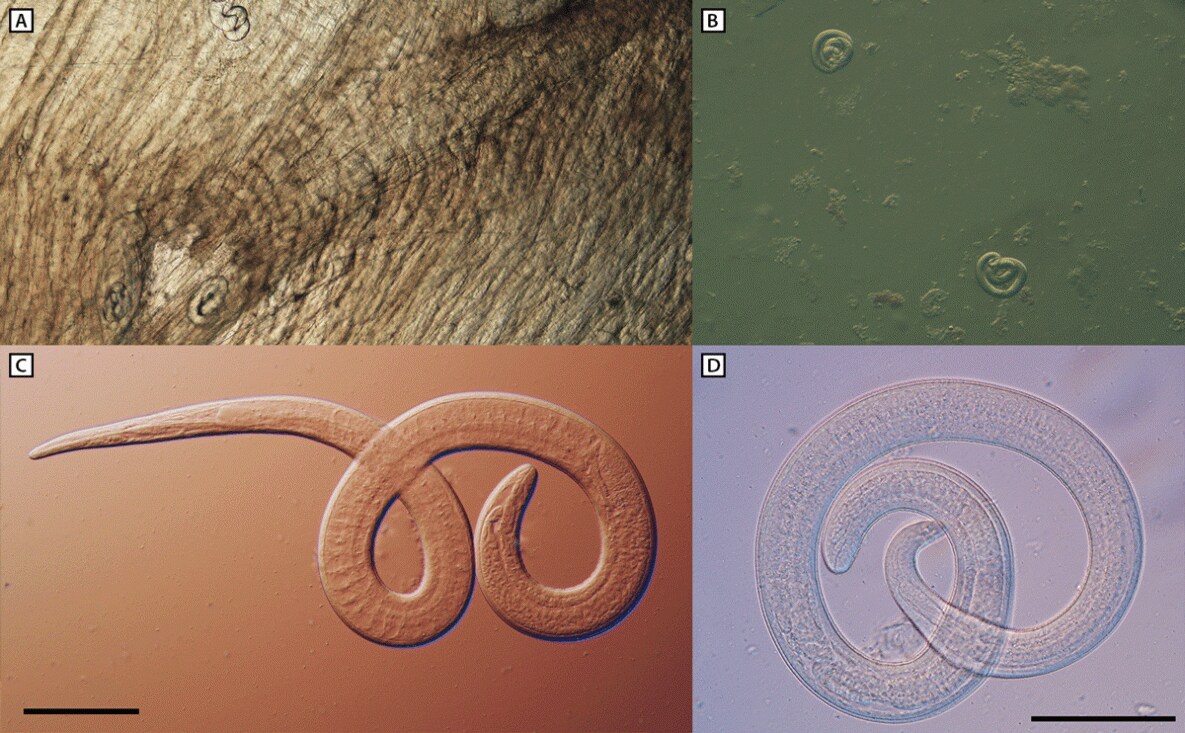 The figure is a series of four photographs illustrating microscopic examination of encapsulated larvae in a direct black bear meat muscle squash prep (A), larvae liberated from artificial digested bear meat (B), motile larvae viewed with differential interference contrast microscopy (C and D) from black bear meat suspected as the source of an outbreak of human Trichinella nativa infections in Arizona, Minnesota, and South Dakota in 2022.